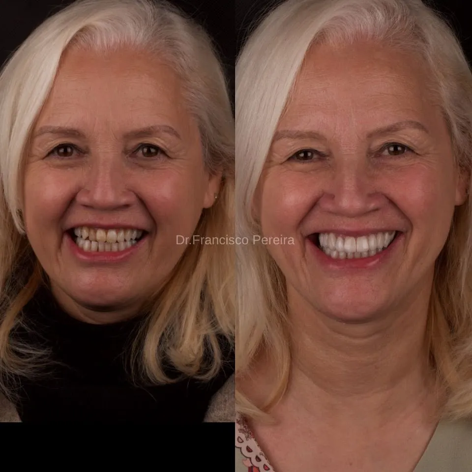 Foto de Odonto Próteses Implantes