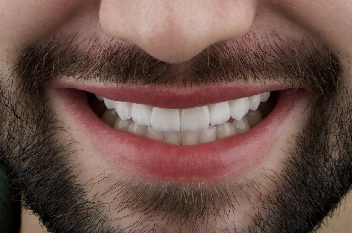 Foto de ATELIÊ ODONTOLÓGICO IVS / "Lentes de Contato Dental & Implantes"